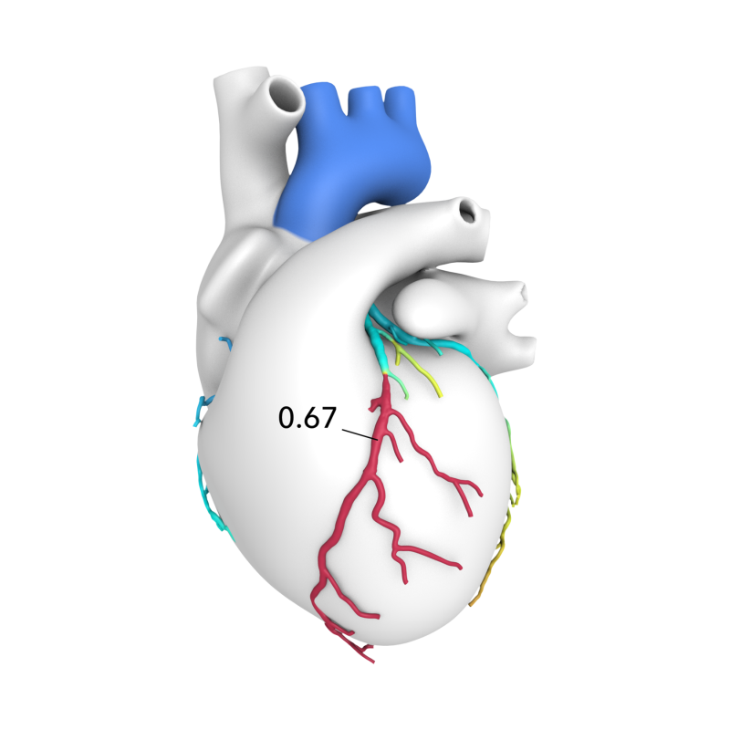 HeartFlow